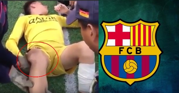 شاهد كيف أعاد الطبيب ركبة لاعب برشلونة الشاب الى مكانها