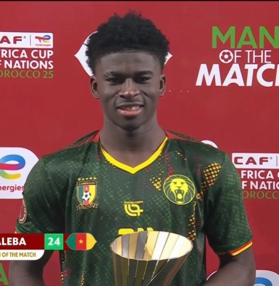 نجم الكاميرون باليبا