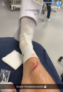 لاعب مانشستر سيتي يصيب هالاند في التدريبات قبل مواجهة ريال مدريد (صورة)